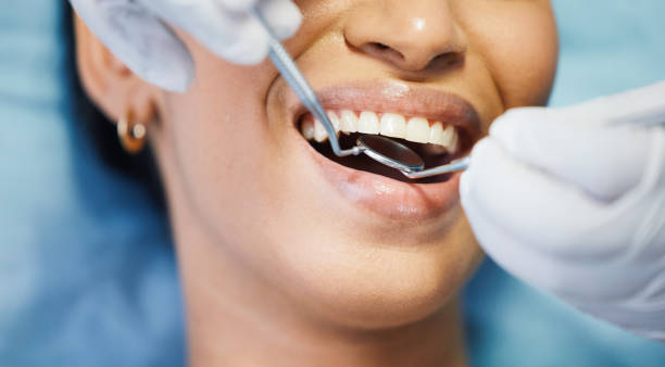 Best Walk-In Emergency Dental Services in Farmington, MO